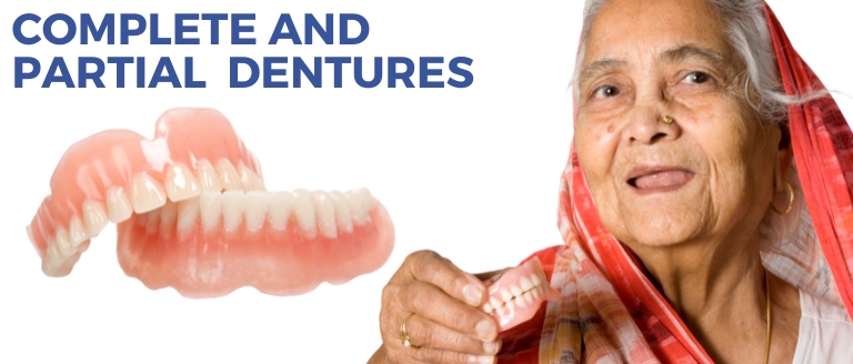 Complete and Partial Dentures